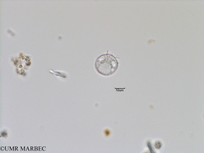 phyto/Bizerte/bizerte_bay/RISCO November 2015/Dinophysis bibulba (Baie_T5-C1-Dinophysis-0).tif(copy)_thumb.jpg